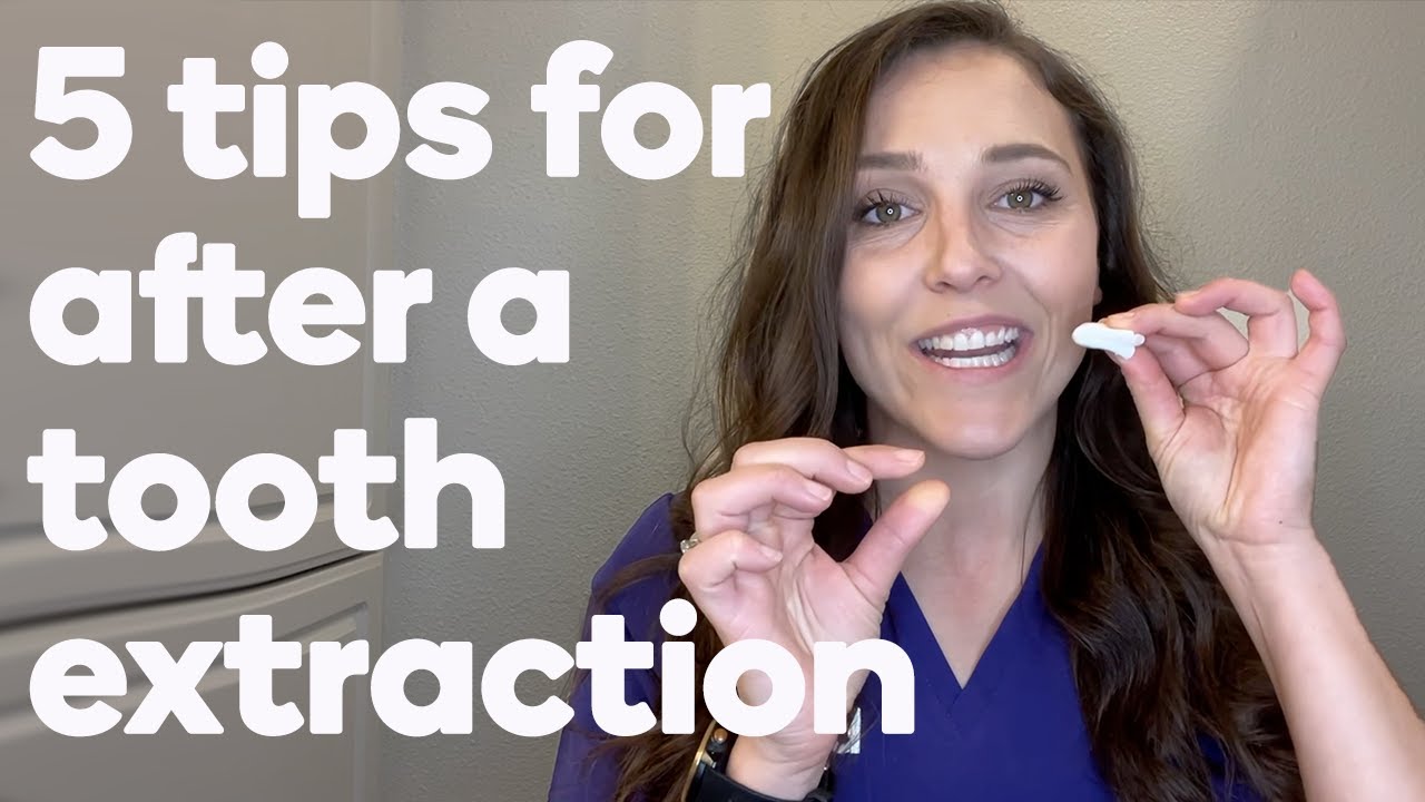 5 things to do after your tooth is extracted