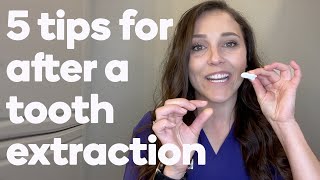 5 things to do after your tooth is extracted