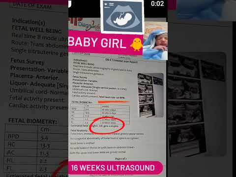 _Fetal heart rates 158 BPM..👩‍⚕️❤️