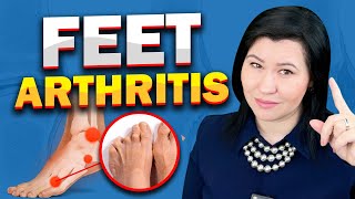 5 Causes for Feet Arthritis -A Rheumatologist Perspective