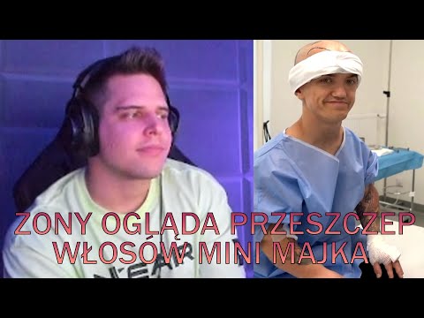 ZONY OGLĄDA PRZESZCZEP WŁOSÓW MINI MAJKA