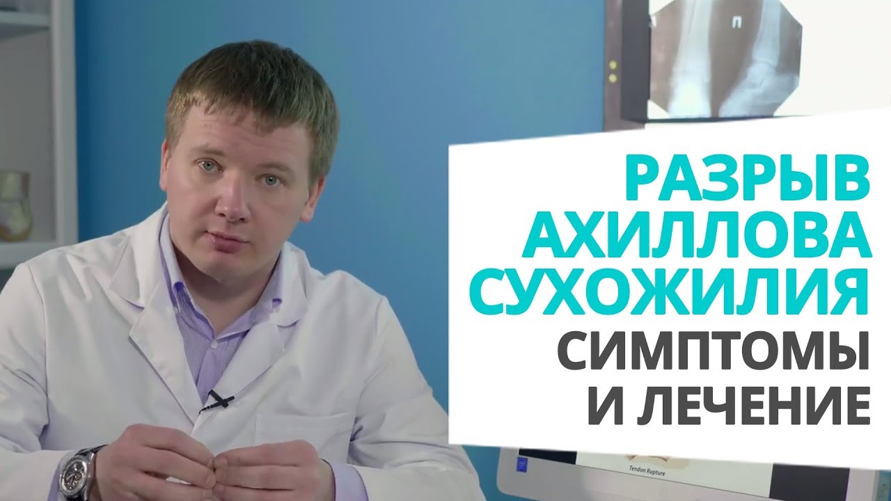 Видео по теме Разрыв Ахиллова сухожилия 