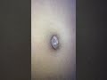 Belly Vaccum And Navel Poking