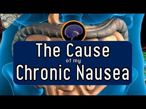 The Cause of my Mysterious Chronic Nausea | ALifeLearned
