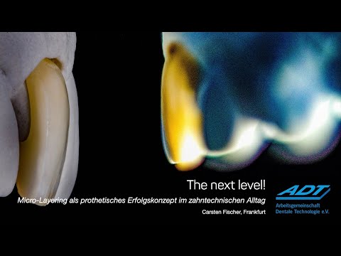 Sirius Ceramics: The next level!