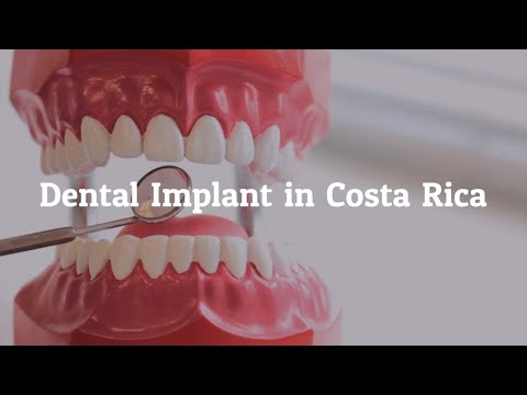 Key Factors to Learn about Dental Implants in Costa Rica