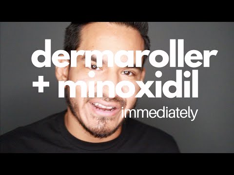 YouTube video about: How long after derma rolling can I use minoxidil?