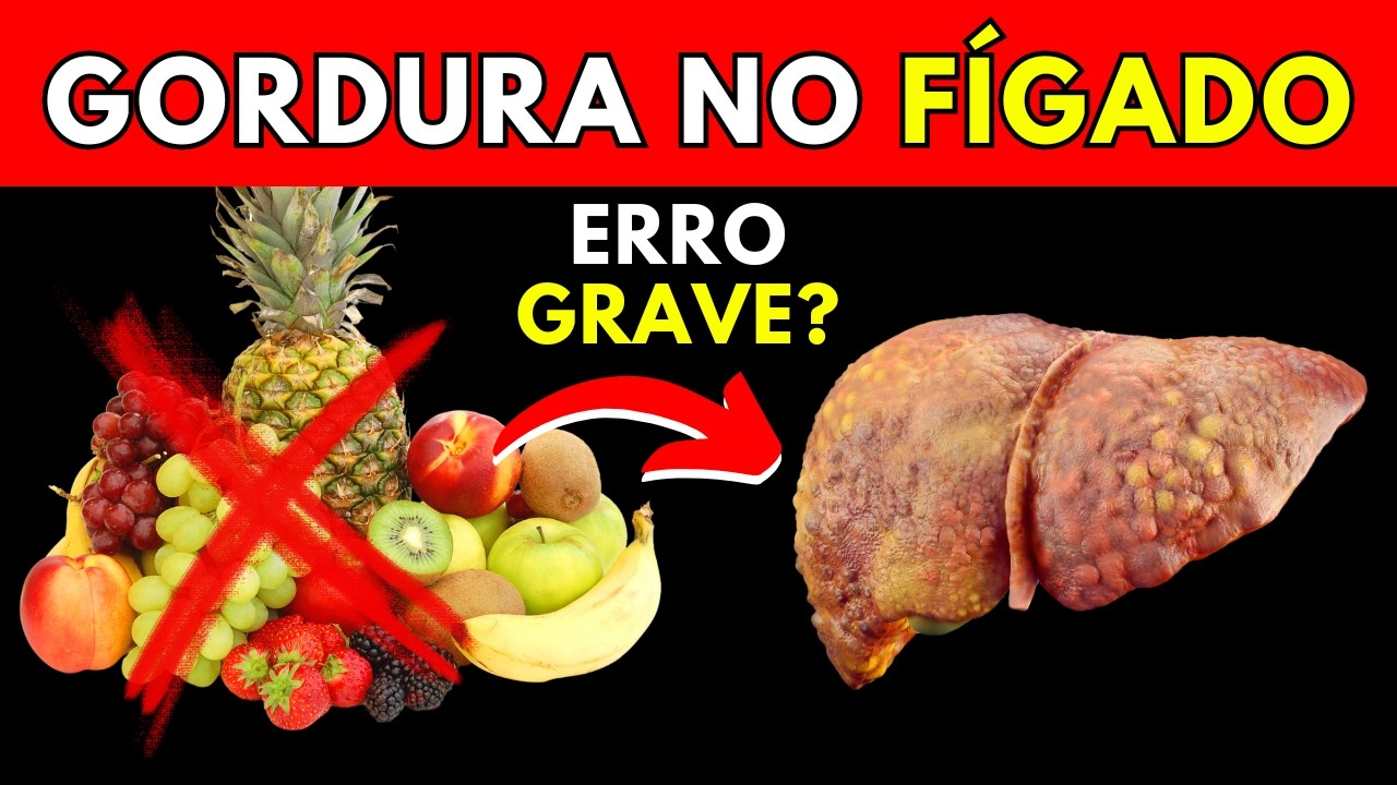 Isto DESTRÓI seu FÍGADO SEM VOCÊ SABER | AS PIORES FRUTAS PARA GORDURA NO FÍGADO