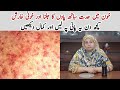 Khoon Ki Garmi Ka Ilaj Khoon Ki Kharabi Blood Heat Treatment Kharish Ka Ilaj