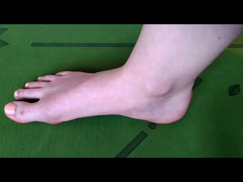 Thema 1 Fuß: 3 Punkte Übung