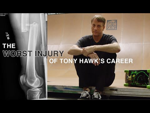 Tony Hawk Breaks Down The Worst Slam Of His Career