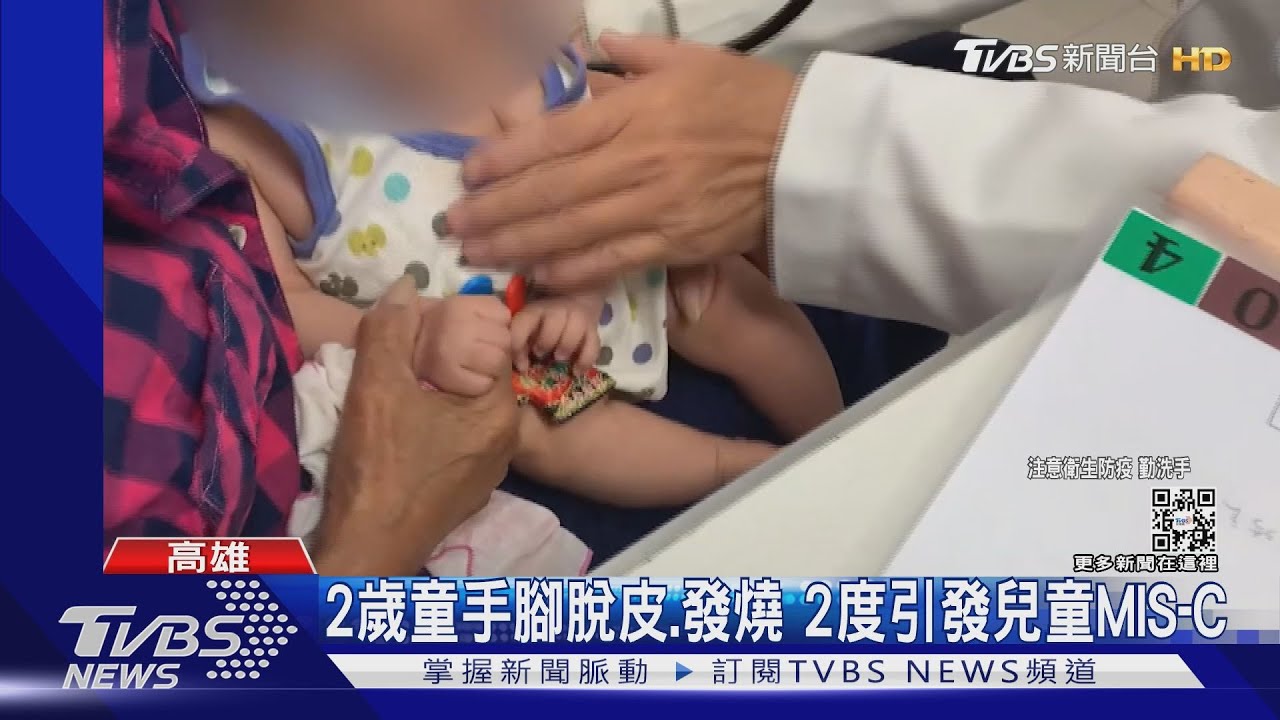 高雄2歲童手腳脫皮、發燒　2度診斷兒童MIS-C