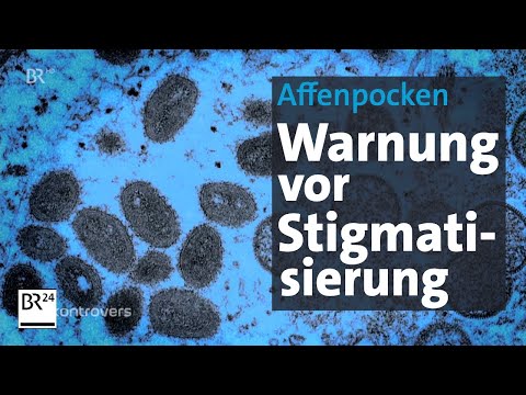 Monkeypox: Is Germany prepared? | Controversial | BR24