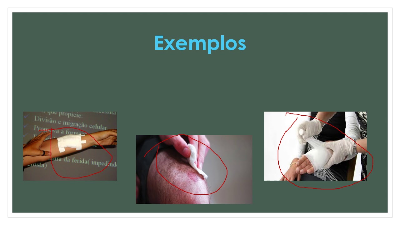Revisão tipos de curativos e cuidados de enfermagem