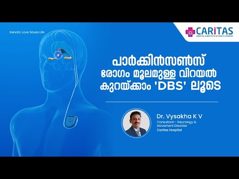 Parkinson's disease tremors can be reduced with 'DBS'