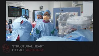 SECONDARY MITRAL REGURGITATION SYMPOSIUM