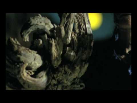 My Shocking Story: Treeman the Cure - Medical History