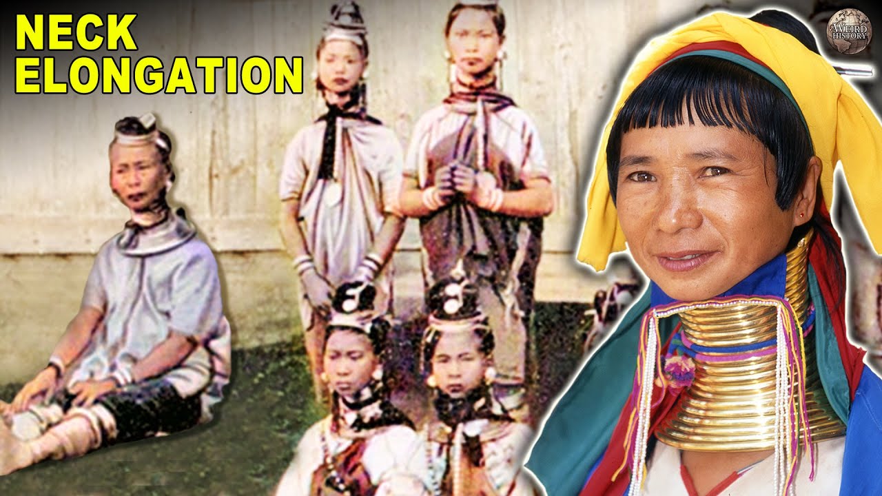 Facts About Neck Elongation