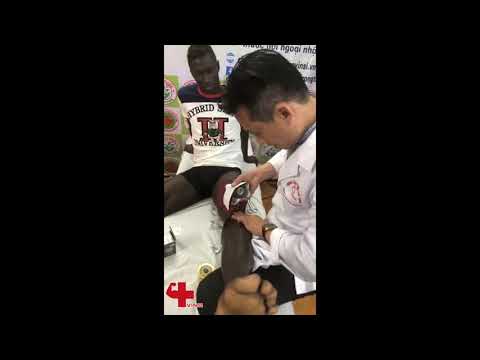 Bài 4: Cách băng đầu gối khi chơi thể thao ( Bóng đá , Tennis , Chạy đường dài , Gym ...)