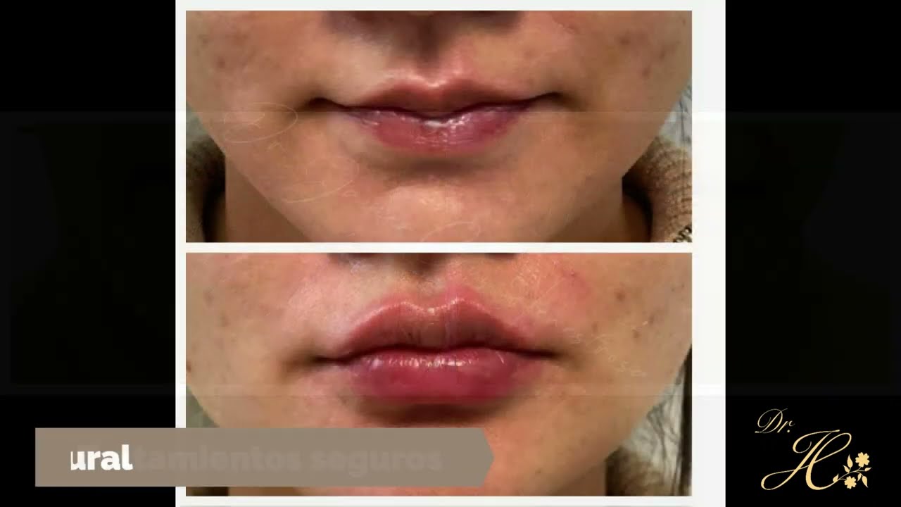 Javier Henestrosa-22