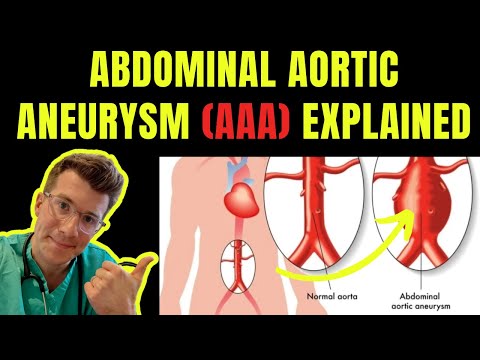 Doctor explains ABDOMINAL AORTIC ANEURYSM (AAA) | Symptoms, risk factors, treatment, screening.
