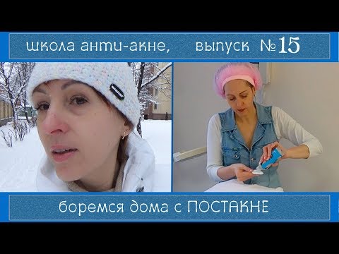 Отзывы об отбеливающих кремах для лица Грибулина веснушки минусовка