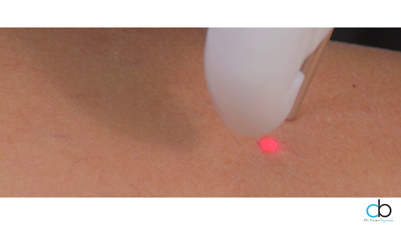 César Noé Bujanda Mena-20