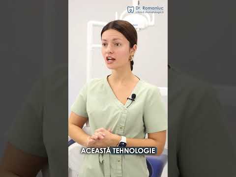 Dantura Fixa pe Implanturi Inovatie pentru un Zambet Perfect