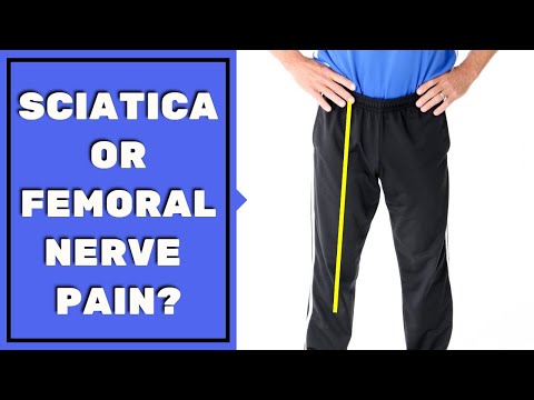 Is Leg Pain Sciatica or Femoral Nerve Pain? Must See to Assess & Stop Pain