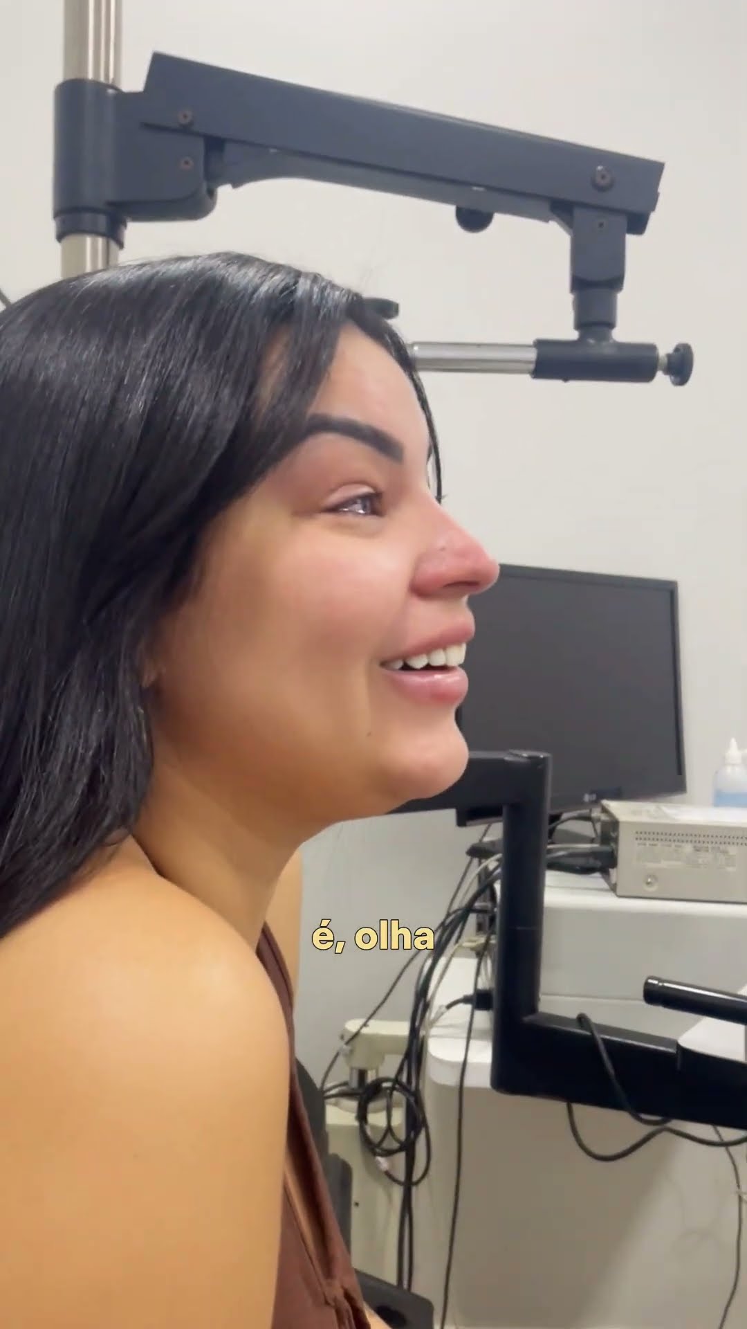 Depoimento da paciente Ana Carolina após cirurgia refrativa a laser no Rio de Janeiro