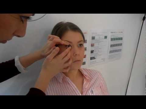 Insertion of a RGP contact lens