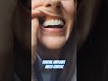 All-on-4 Dental Implant Arch Check! Smile by: @jaximplantsanddentures #teeth #dentalimplants