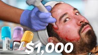 I Got A $1,000 Blood Facial