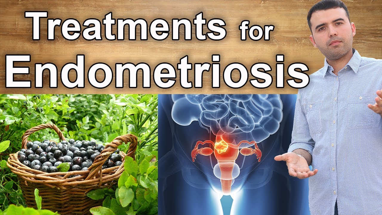 Natural Treatments for Endometriosis – Home Remedies, Supplements and Diets to Treat Endometriosis
