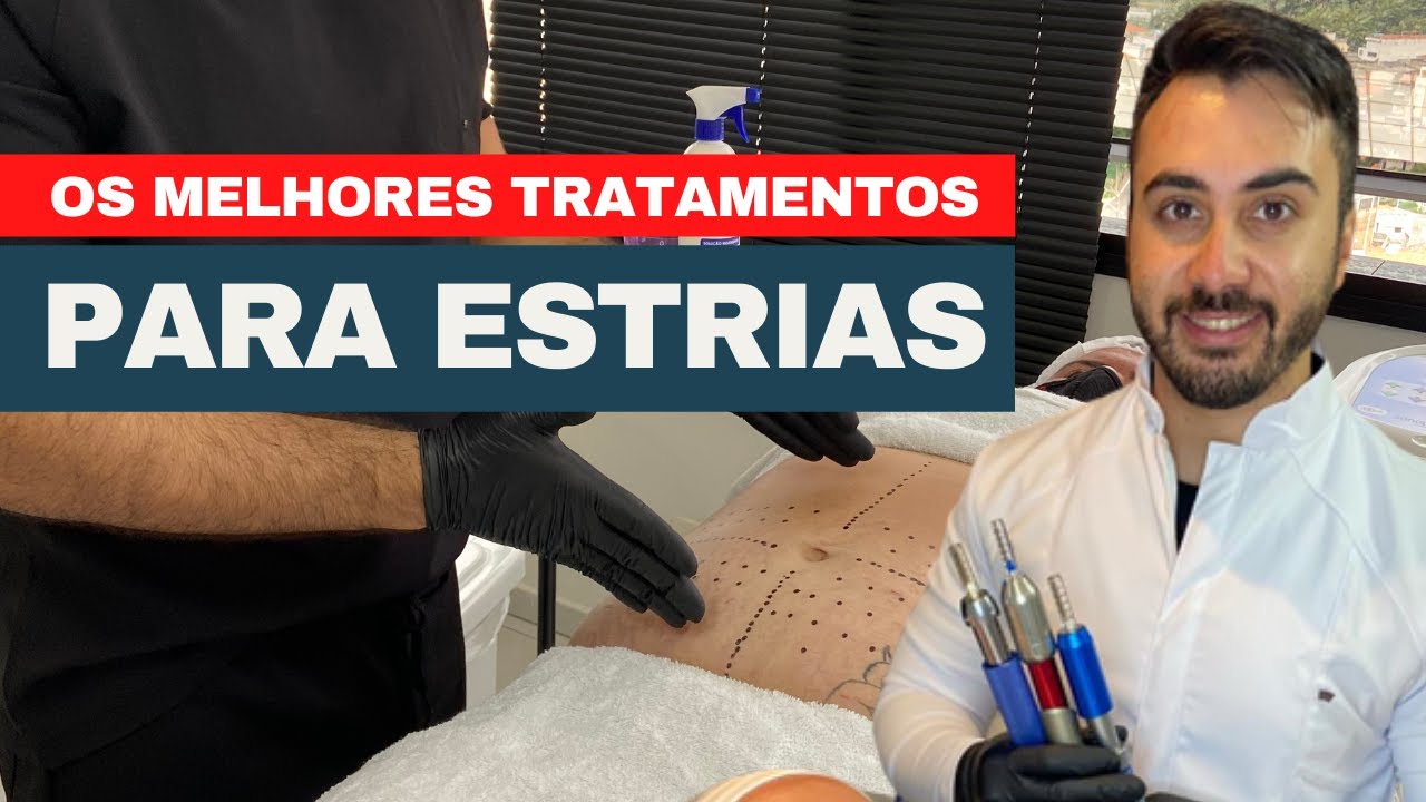 Os melhores tratamentos para estrias 2021