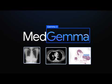 MedGemma - An Open Doctor Model?