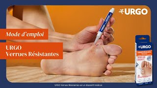 Eliminez les verrues les plus tenaces à domicile !