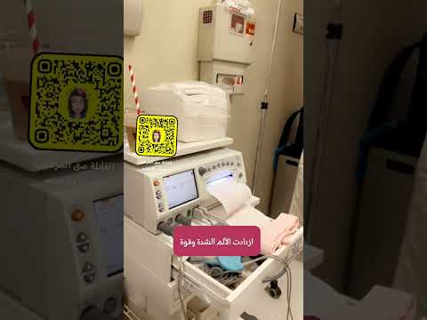 ولادة طبيعية بكرية بـ٩ ساعات فقط من المخاض