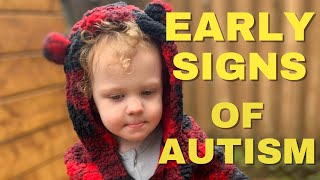 AUTISM EARLY SIGNS 2 YEAR OLD (includes footage)