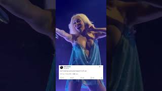 Doja Cat has capsular contracture