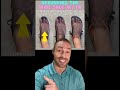 The PROBLEM With Wide Shoes