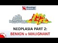 2. Neoplasia part 2: Differences between benign and malignant neoplasms