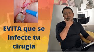 What should you do AFTER ORAL SURGERY?