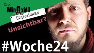 Das Minoxidil Experiment #Woche24 Vom unsichtbaren Bart