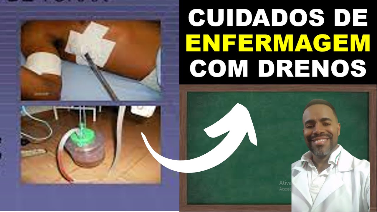 CUIDADOS DE ENFERMAGEM COM DRENOS