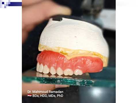 Step by step complete denture construction