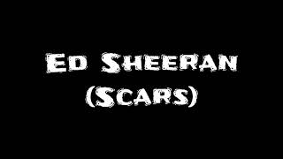 Scars - Ed Sheeran