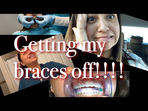 Getting my BRACES taken off!!