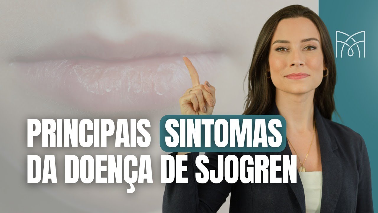 Principais sintomas de Síndrome de Sjogren