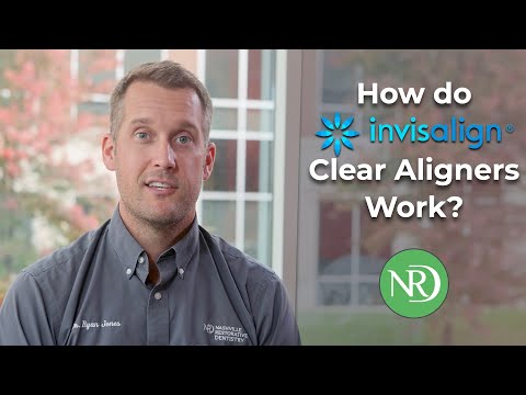 How Do Invisalign Clear Aligners Work?